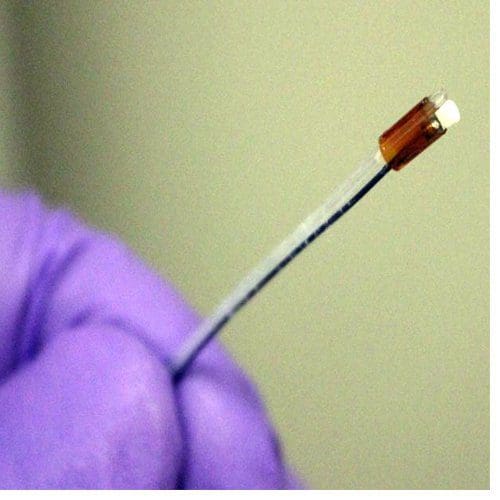 New Ultrasound ‘Drill’ Targets Deep Vein Blood Clots