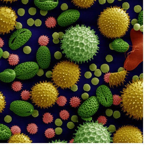 Various common pollens as seen through an electron microscope.
